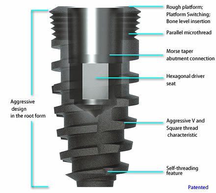 octo-implant-advantages