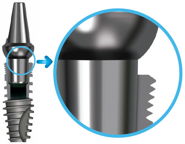 octo-implant-morse-taper-araliksiz-temas-yuzeyleri